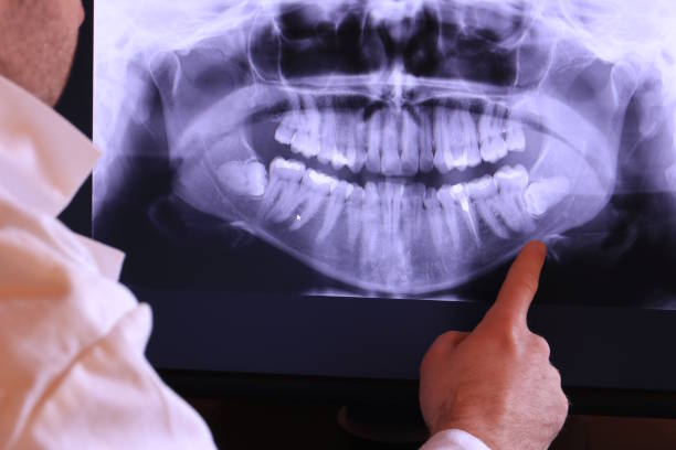 Best Cracked Tooth Emergency Dentist  in Saxon, SC